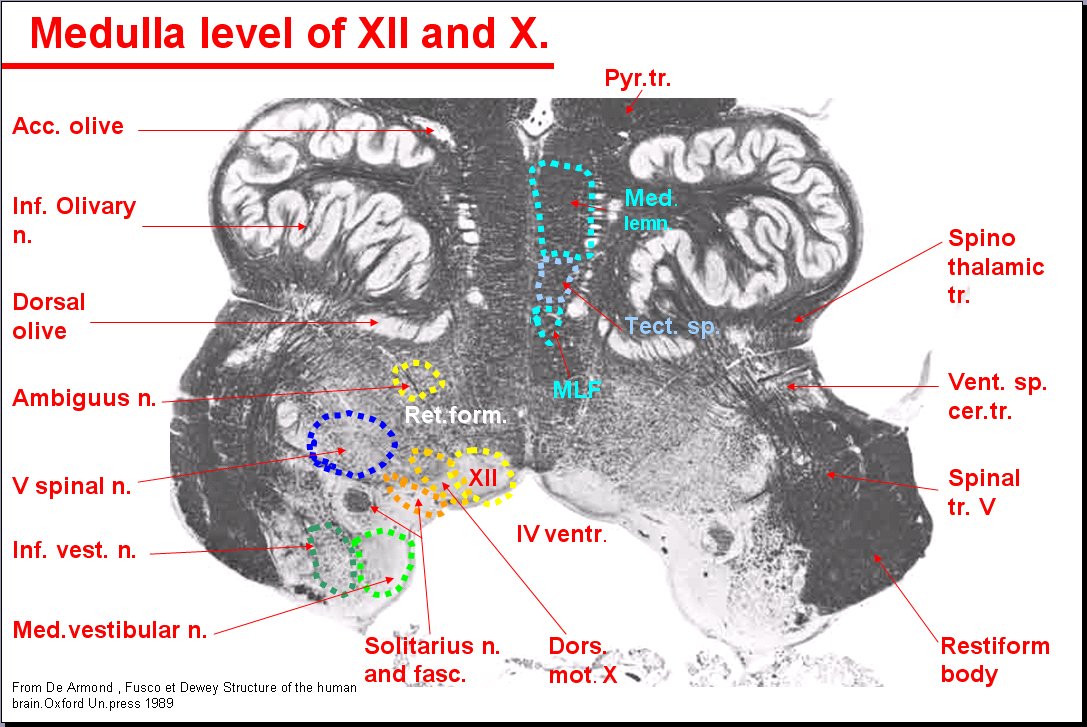 Salamons Neuroanatomy And Neurovasculature Web Atlas Resource